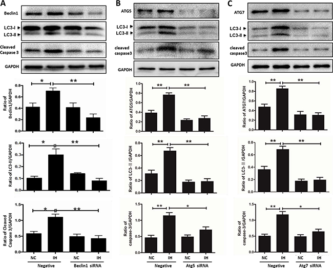 siRNA targeting autophagy-related genes alleviates hippocampal neuronal apoptosis in intermittent hypoxia.