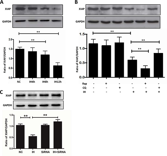 The inhibition of XIAP might be the reason for apoptosis caused by autophagy in intermittent hypoxia.