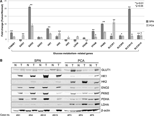 mRNA expression profiles and protein levels of genes for glucose metabolism in SPN.
