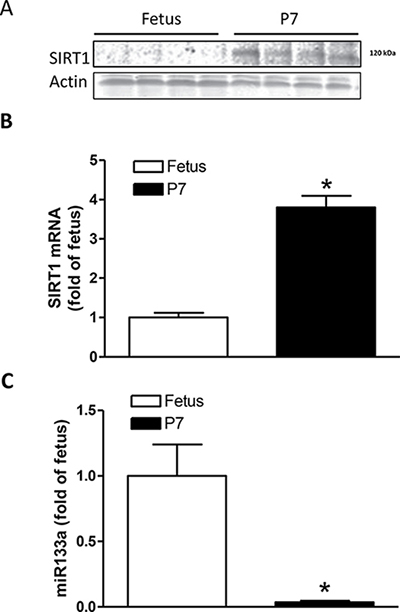 Expression of SIRT1 and miR133a in the developing heart.