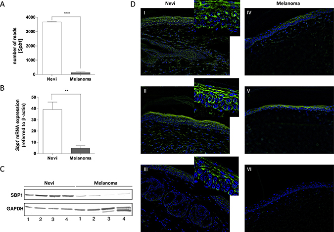 SELENBP1 expression in murine Tg(Grm1) melanoma tissue.