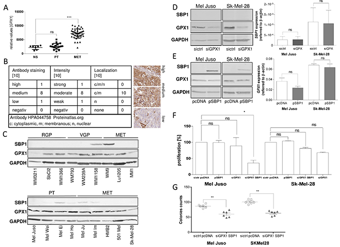 Connection between SELENBP1 and GPX1.