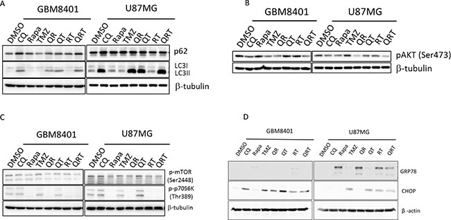 Autophagy, ER stress, and p-AKT change after CQ (Q), Rapa (R) and TMZ (T) in different combination treatment.