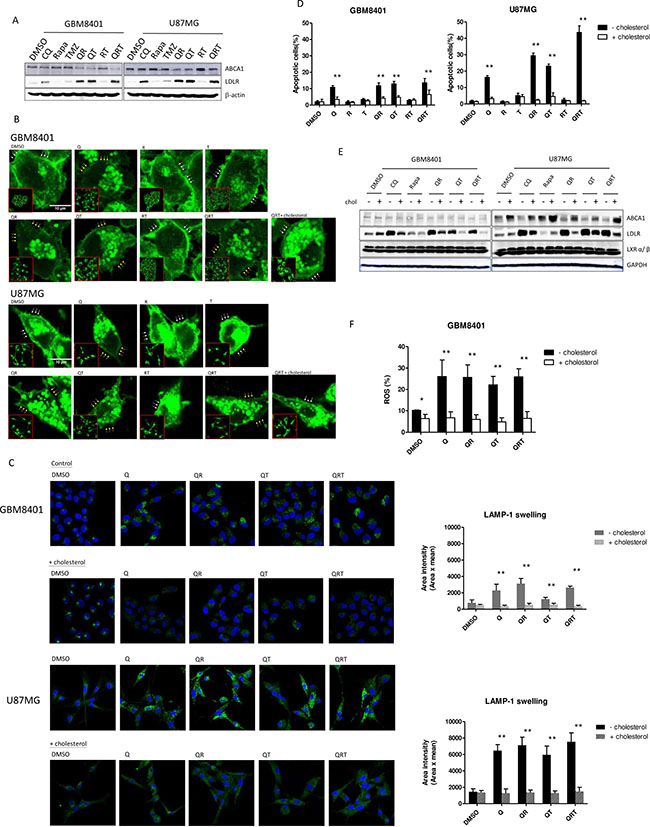 Changes of cholesterol homeostasis under CQ (Q), Rapa (R) and TMZ (T) in different combination treatment.