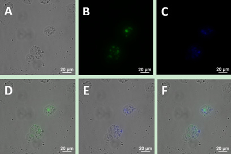 Upconversion fluorescence images of Jeko-1 cells after incubation of cells with a mixture including the UCNP-CD20 antibody conjugates and UCNP-CD5 antibody conjugates for 2 h.