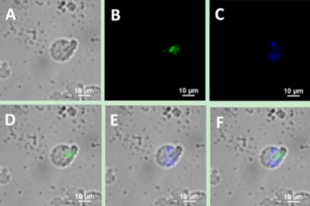 Upconversion fluorescence images of SP50B cells after incubation of the cells with a mixture containing UCNP-CD20 antibody conjugates and UCNP-CD5 antibody conjugates for 2 h.