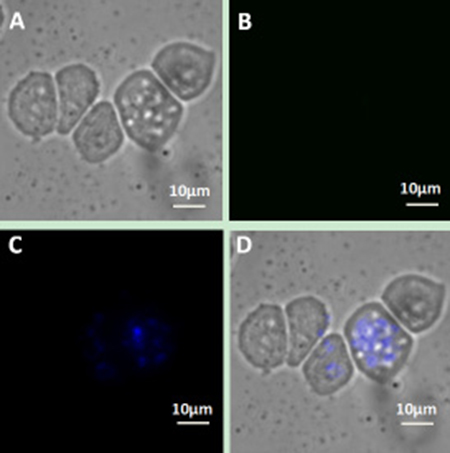 Upconversion fluorescence images of Jeko-1 cells after incubation of the cells with a mixture containing NaYF4:Er3+ nanoparticle suspension without CD20 antibody and CD5 antibody-NaYF4: Yb3+/Tm3+ nanoparticle suspension for 2 h.