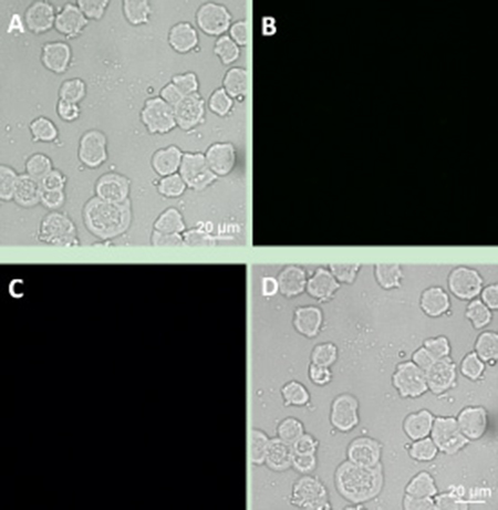 Upconversion fluorescence images of Jeko-1 cells after incubation of the cells with a mixture containing NaYF4: Er3+ nanoparticle suspension and NaYF4: Yb3+/Tm3+ nanoparticle suspension without any antibody for 2 h.