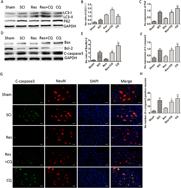 Resveratrol alleviates the neuronal apoptosis by ameliorating autophagic flux after acute SCI in SD rats.
