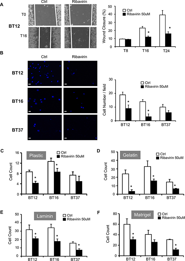 Ribavirin reduces AT/RT migratory, invasive, and adhesive capacities.