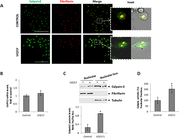 Role of MAPK/PI3K signaling pathway in the nucleolar localization of calpain-2.