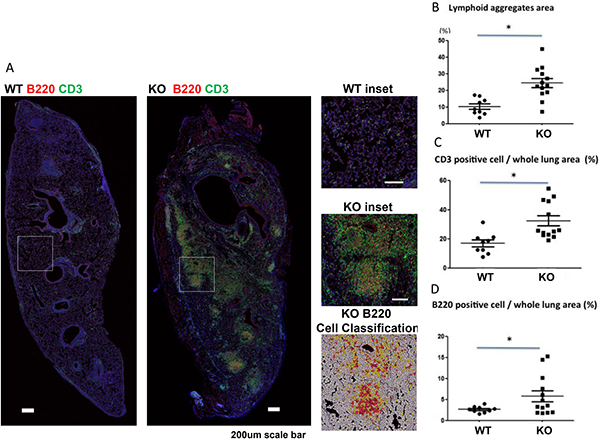 Increased lymphoid aggregates in lung grafts of KO (n = 9) compared to WT (n = 13) mice.