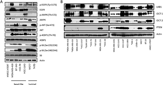 Dysregulation of signaling pathways and loss of PTEN expression in a panel of breast cancer cell lines.