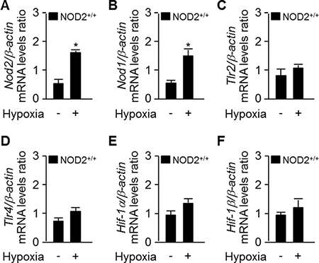 Nod2 expression is enhanced in the mouse lung after chronic hypoxia.