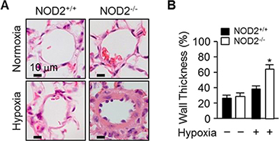 NOD2 deficiency enhances pulmonary vascular remodeling after chronic hypoxia.