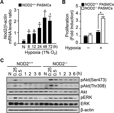 Absence of NOD2 during hypoxia enhances PASMC proliferation.