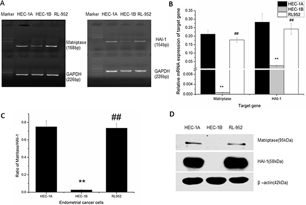 Expression of matriptase and HAI-1 in HEC-1A, HEC-1B, and RL-952 endometrial cancer cells.