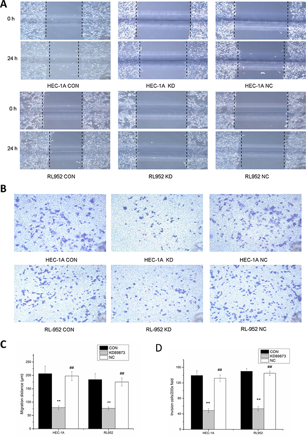 Inhibition of the migration and invasion ability of endometrial cancer cells by down-regulation of matriptase with siRNA.