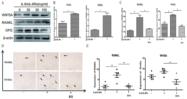 Changes in IL-6/sIL-6R&#x03B1;&#x2013;induced RANKL and WNT5A expression after M10 pretreatment of RA FLS.