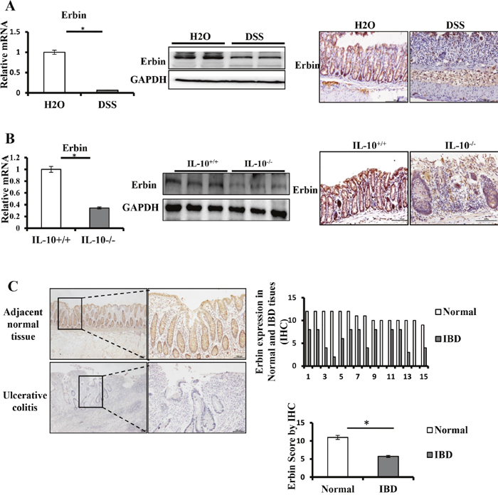 Expressions of Erbin in DSS-induced colitis model of mice and IL-10-/- mice.
