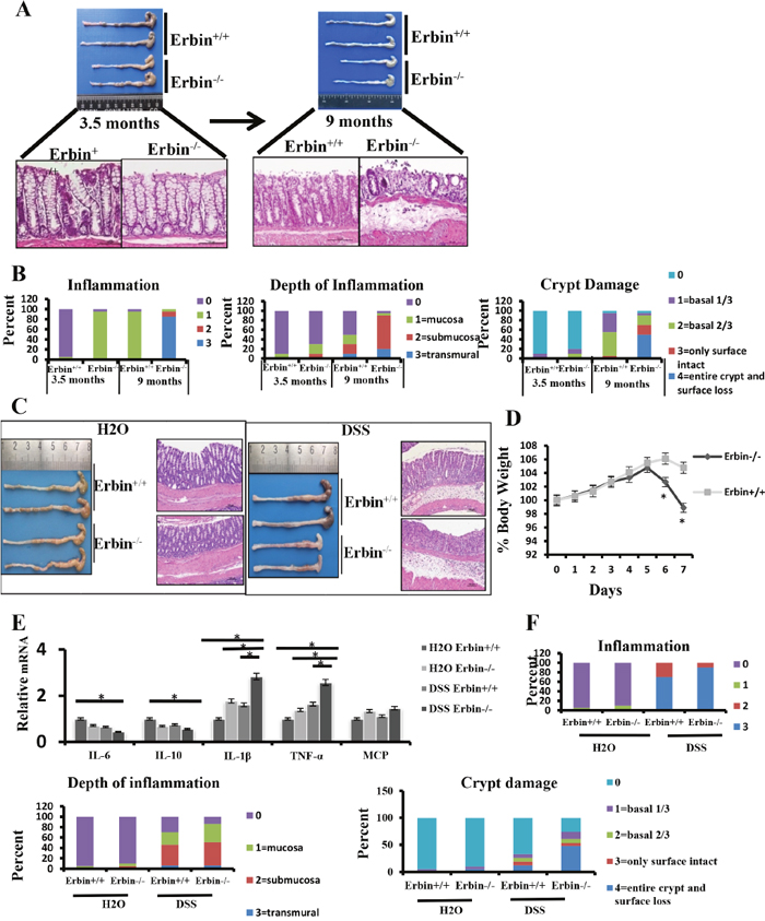 Intestinal inflammatory response and epithelial injury in experimental colitis mouse model after Erbin was deleted.