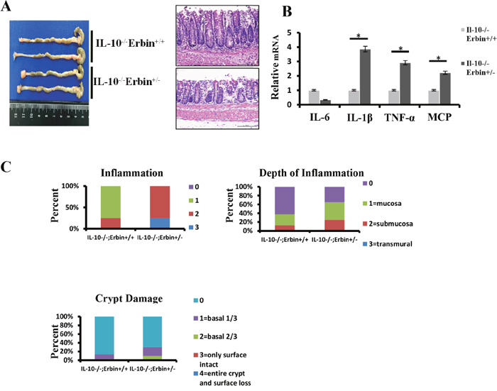 Intestinal inflammatory response and epithelial injury in IL-10-/- Erbin+/- mice.