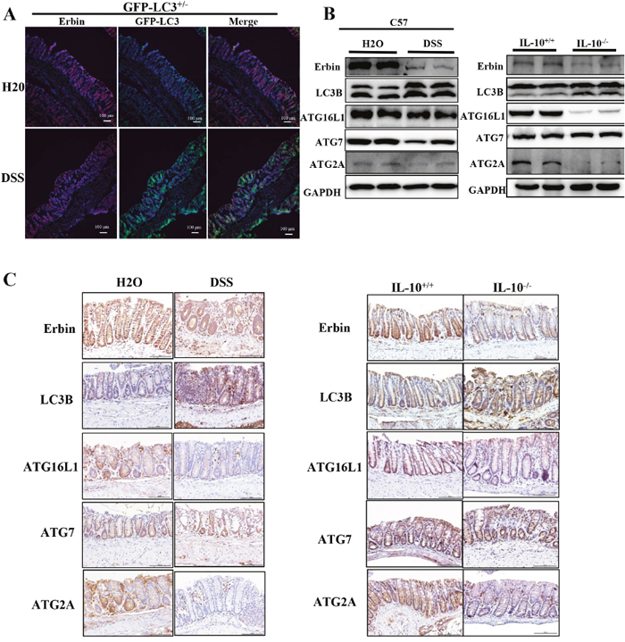 Expressions of Erbin, LC3, ATG16L1, ATG2A and ATG7 in DSS-induced experimental colitis mice and IL-10 knockout mice (IL-10-/-).