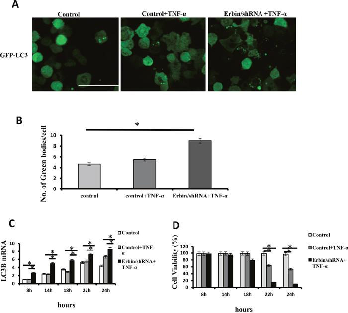 Autophagic cell death of CT26 cells after Erbin knockdown and TNF-&#x03B1; treatment.