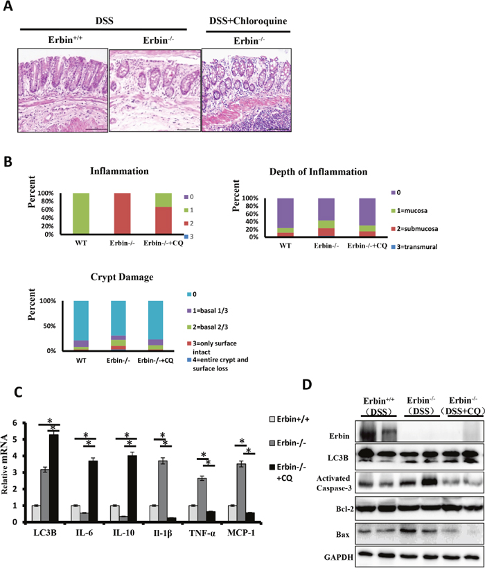 Intestinal inflammatory response and epithelial injury in the DSS-induced colitis mouse model of Erbin deletion after Chloroquine treatment.