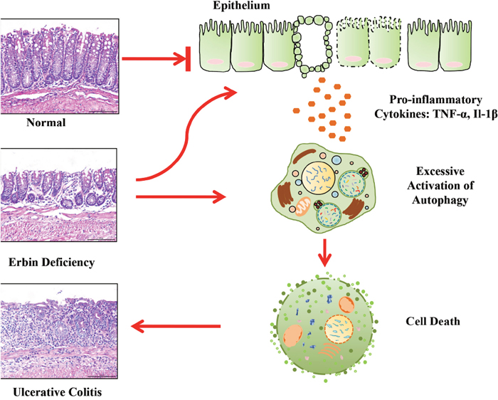 A proposed model for a novel role of Erbin in IBD and colonic homeostasis.