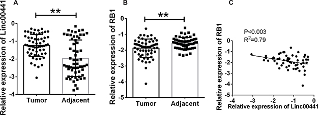 Relative expression of Linc00441 and RB1 in patients with gastric cancer.