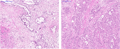 Histology images of FFPE slides from two representative cases.