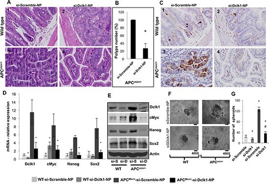 Figure 5. Dclk1 knockdown decreases polyps and dysplasia/adenocarcinoma and tumor stemness