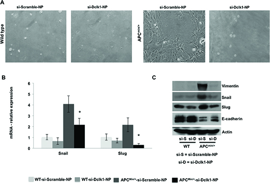 Figure 6. knockdown of Dclk1 decreases the process of EMT in the IECs of ApcMin/+ mice