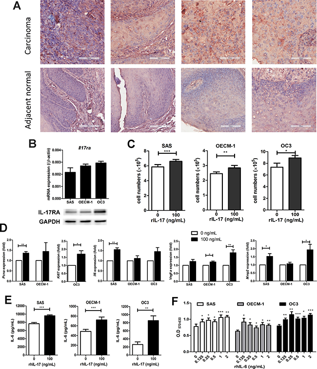 IL-17 induces the proliferation of oral squamous carcinoma cells (OSCC) proliferation through the production of IL-6.