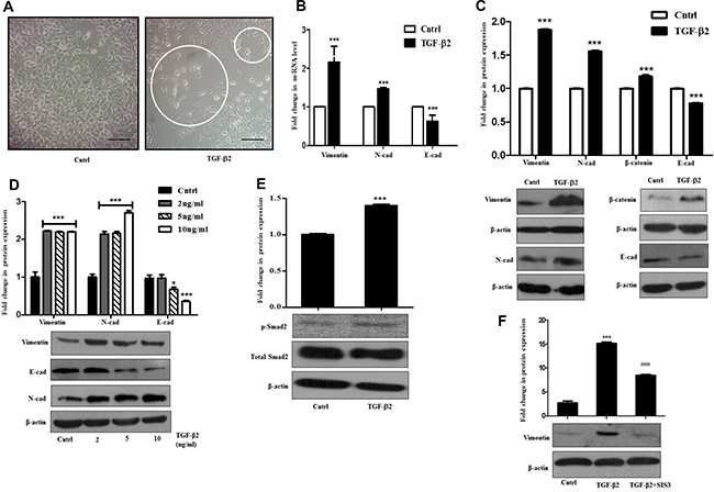 TGF-&#x03B2;2 induces EMT through Smad signaling in Huh7 cells.