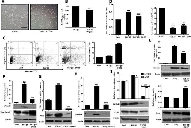 TGF-&#x03B2;2-induced autophagy suppresses ROS and promotes EMT.