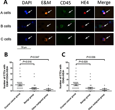 Representative images for three CTC types captured from peripheral blood of patients with suspicious abdominal masses.