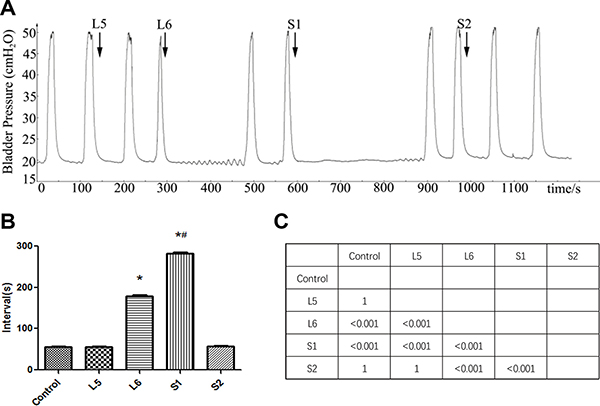 Effect of DRT stimulation on bladder reflex contraction (BRC).