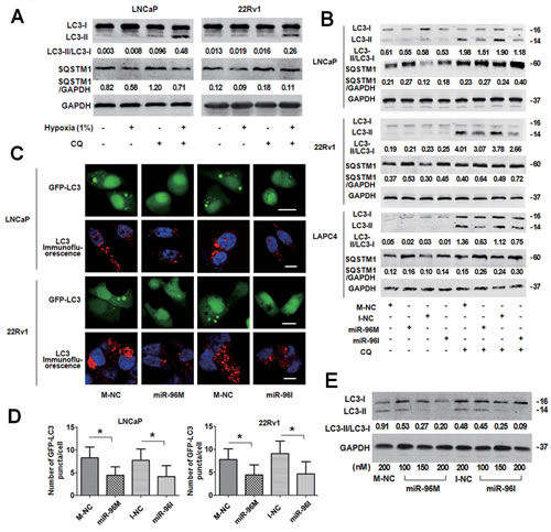 Transfection of miR-96M or miR-96I inhibited hypoxia-induced autophagy in prostate cancer cell.