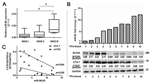 miR-96 expression level in prostate cancer tissues is correlated with clinical parameters.