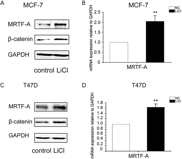 LiCl induced the accumulation of &#x03B2;-catenin protein and the up-regulation of MRTF-A transcription in breast cancer cells.
