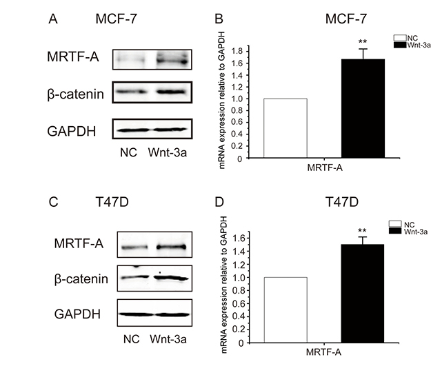 Wnt3a induced the accumulation of &#x03B2;-catenin protein and the up-regulation of MRTF-A transcription in breast cancer cells.