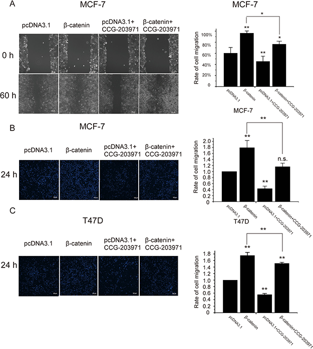 MRTF-A transactivity was required for the &#x03B2;-catenin-stimulated migration of breast cancer cells.