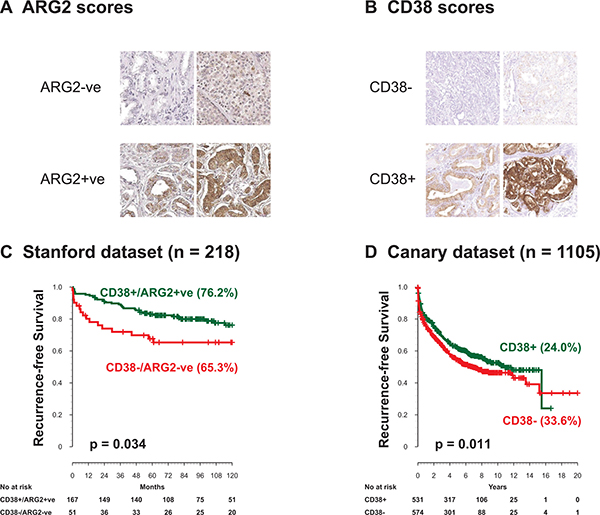 ARG2 and CD38 protein levels by IHC and outcome after surgery.