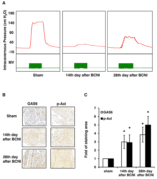 GAS6 and p-AXL are expressed in the regenerative cavernous nerve of rats subjected to BCNI.