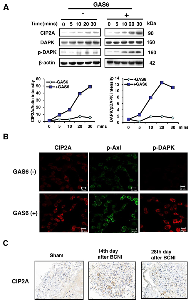 GAS6 increases the amount of both CIP2A and p-DAPK in RSC96 cells.