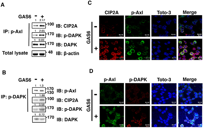 GAS6 triggers p-Axl, p-DAPK and CIP2A to form a protein complex in RSC96 cells.