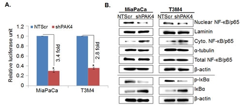 PAK4 induces transcriptional activity of NF-&#x3ba;B/p65 in human pancreatic cancer cells by promoting its nuclear translocation.