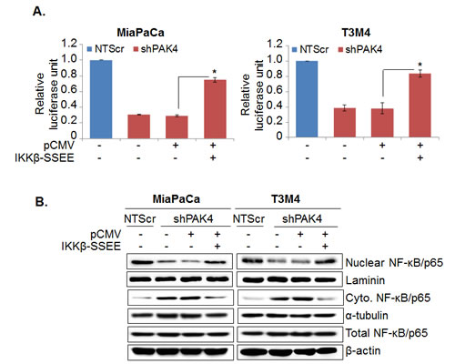 NF-&#x3ba;B-mediates PAK4-induced proliferation and apoptosis resistance in pancreatic cancer cells.